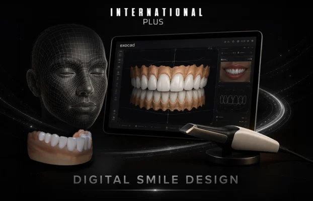 Hollywood Smile Procedure: Step-by-Step Treatment Guide & Steps