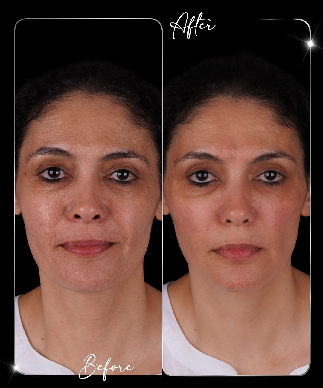 Paris-Shine-Before-After-1
