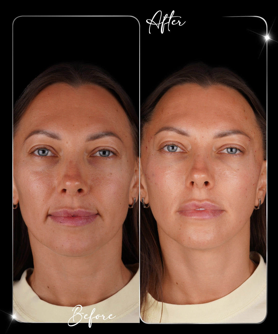 Paris-Shine-Before-After-2