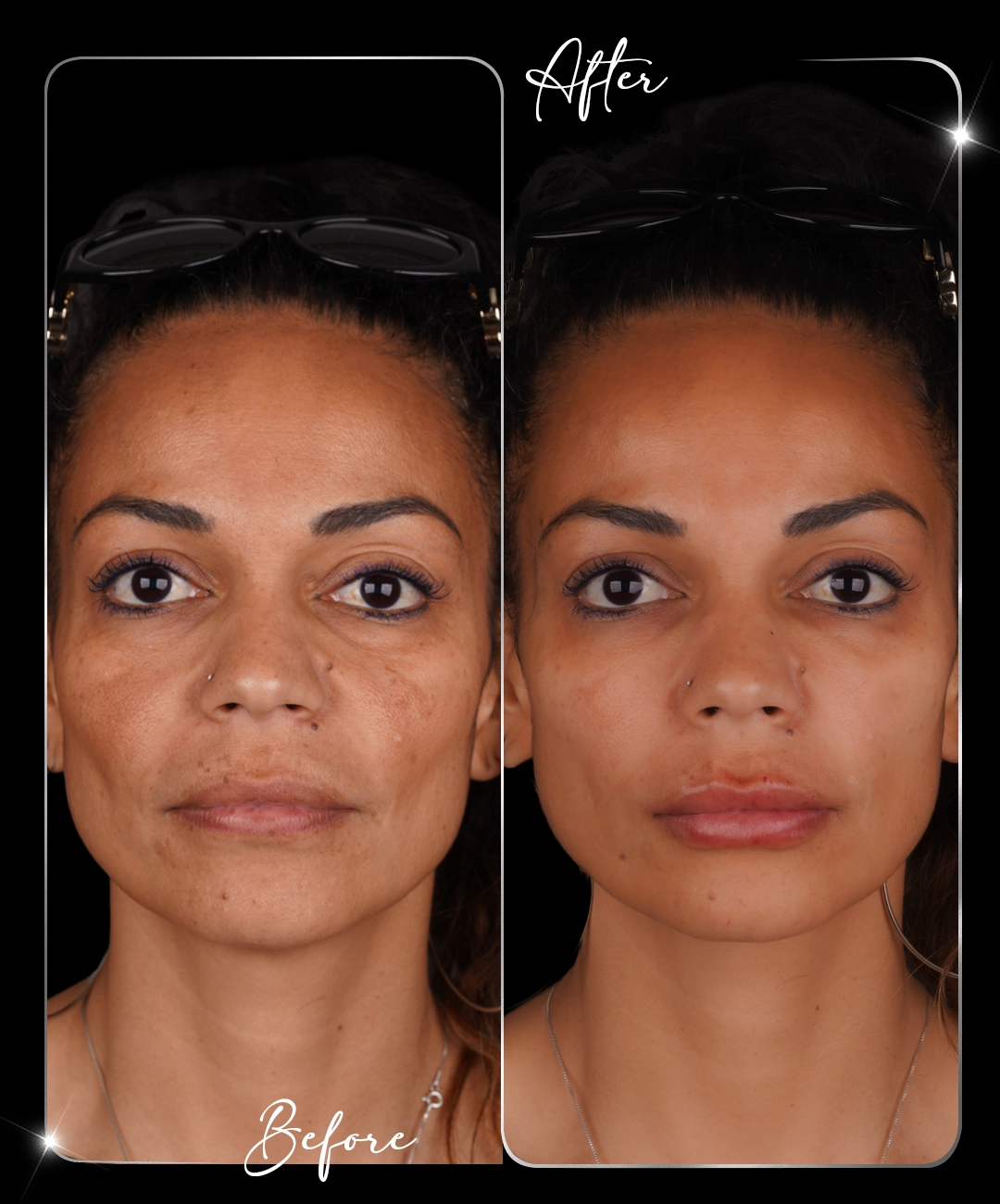 Paris-Shine-Before-After-3