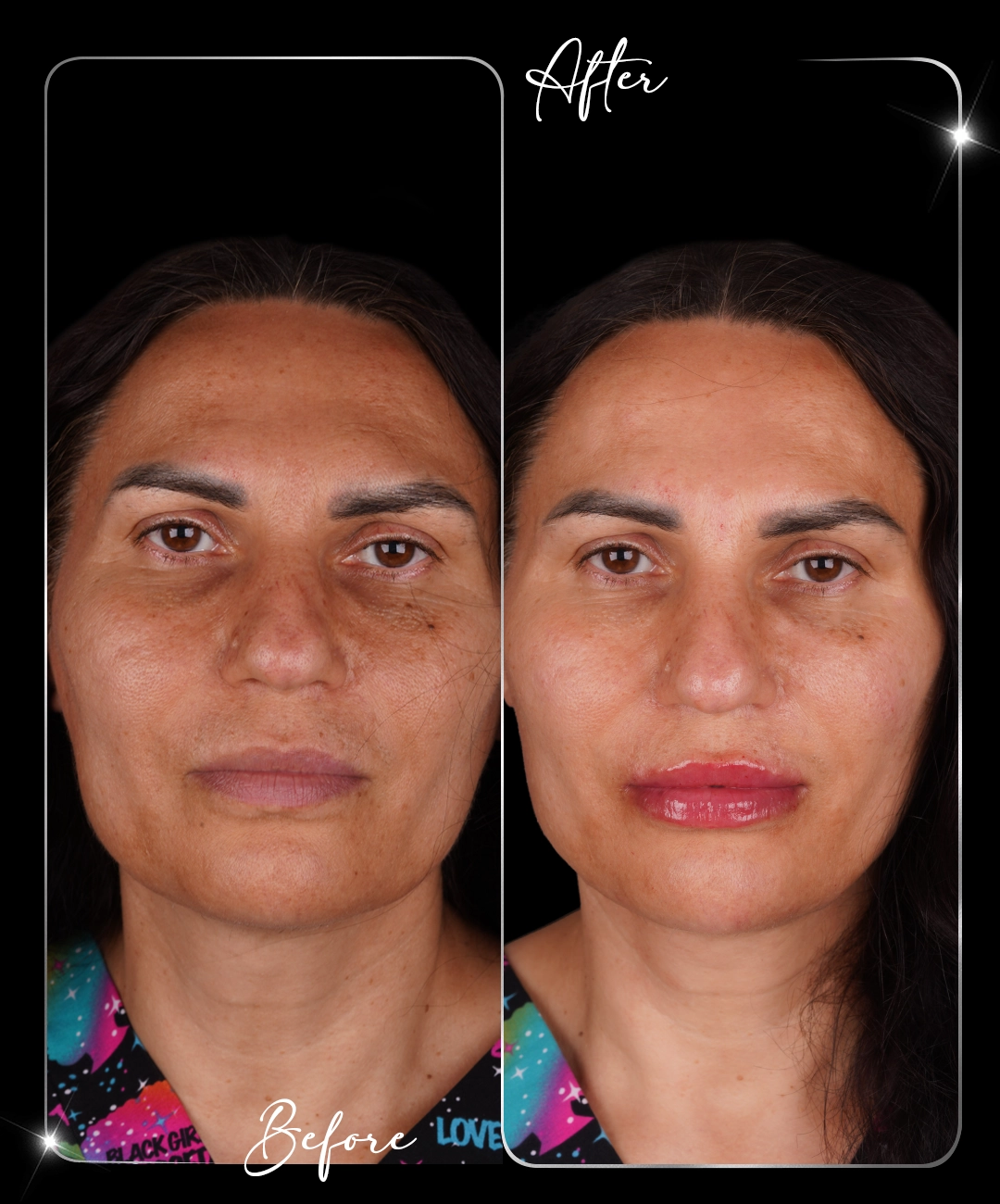 Paris-Shine-Before-After-4
