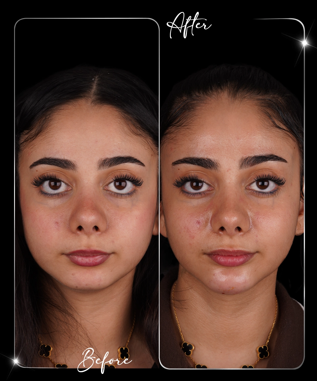 Paris-Shine-Before-After-5