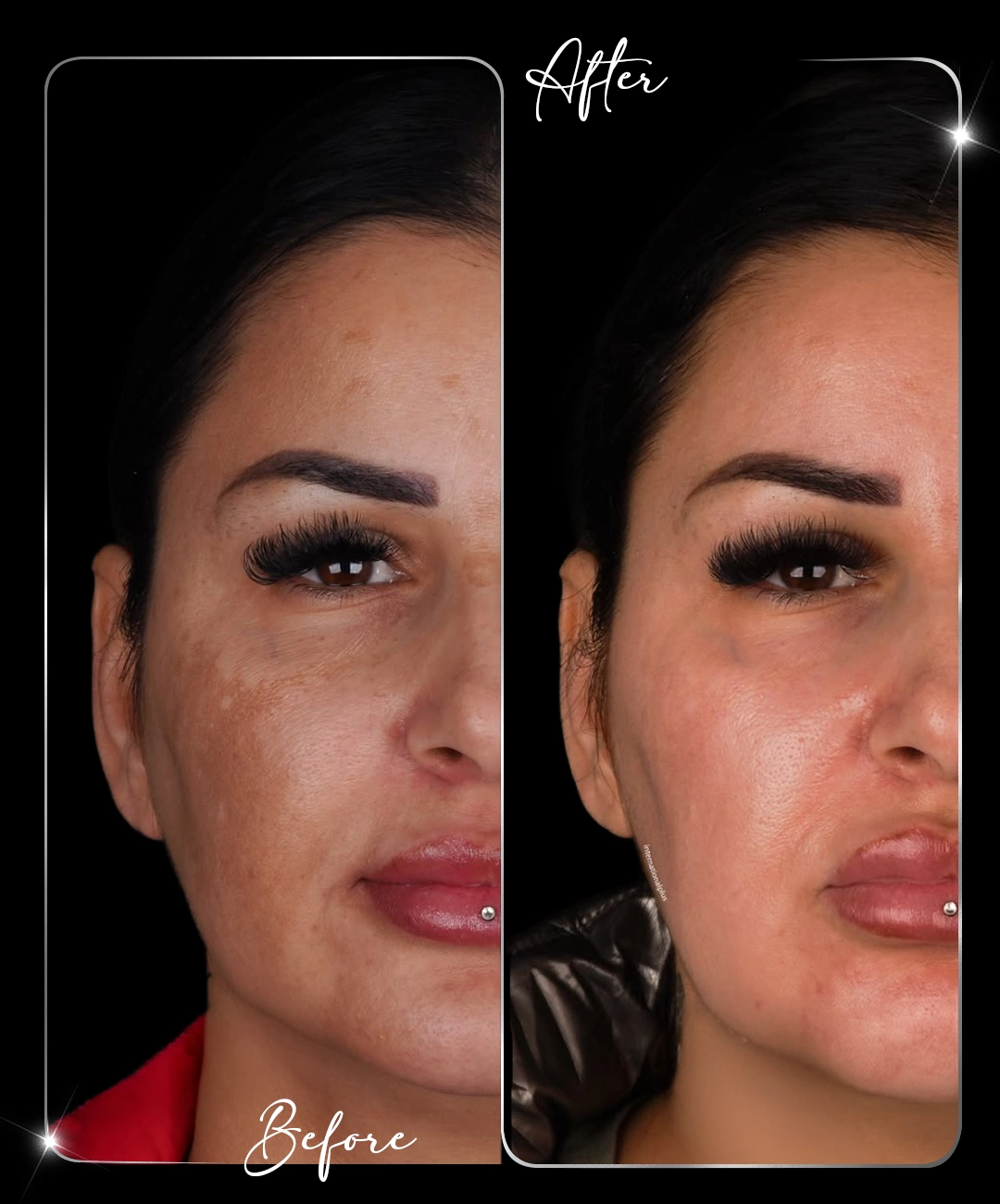 Paris-Shine-Before-After-7