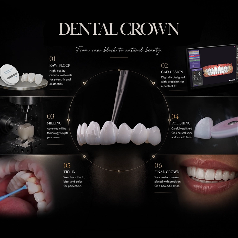Why Choose Us for Dental Crowns in Istanbul, Turkey?