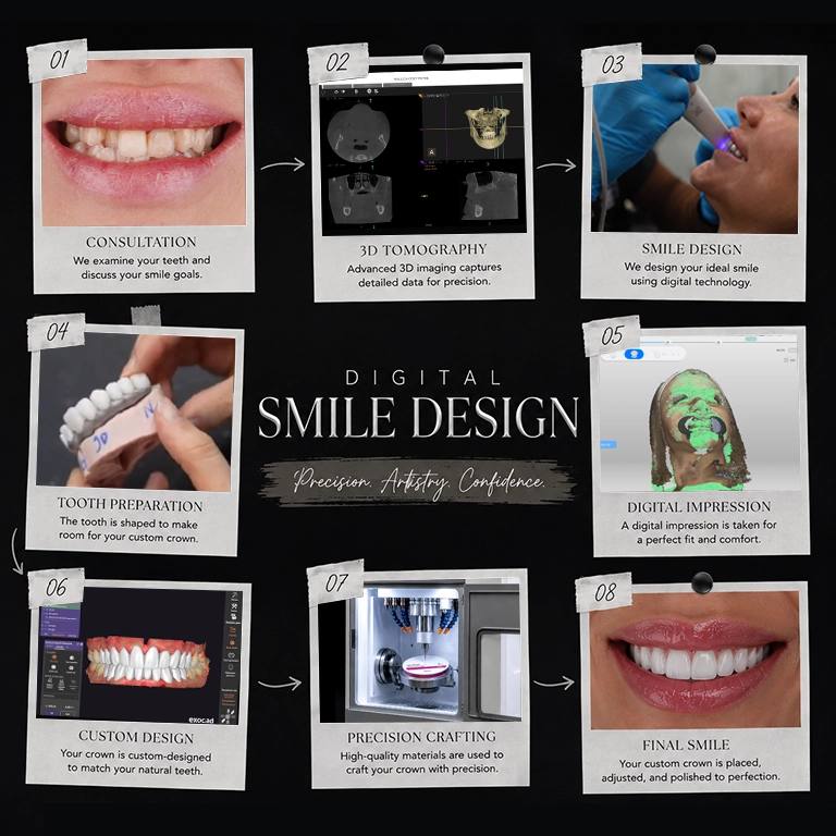 Preview Your New Smile with Digital Smile Design