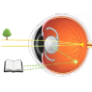 Bifocal IOL