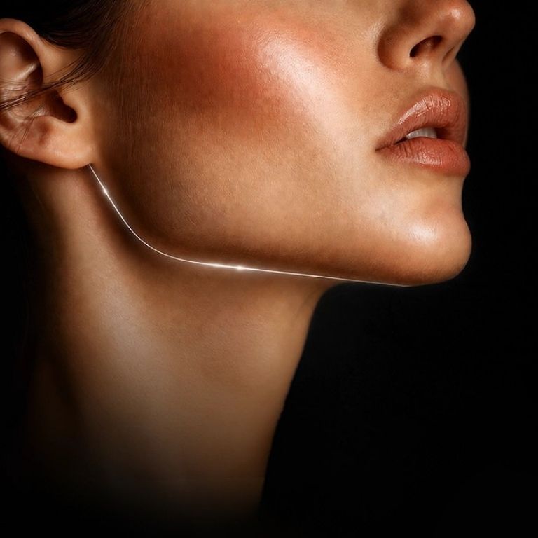 Jawline Filler